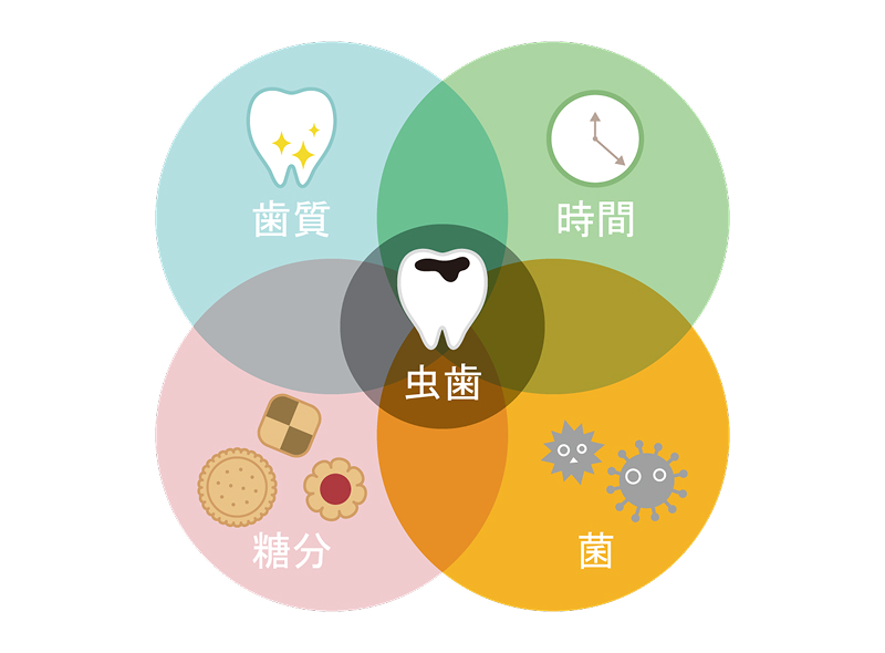 細菌・糖質・歯質・時間という4つの要素を表した図